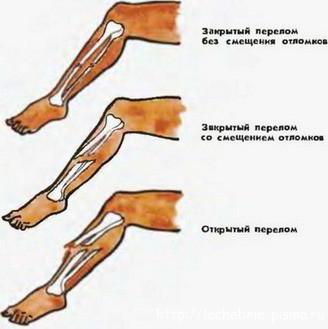 clasificarea oaselor