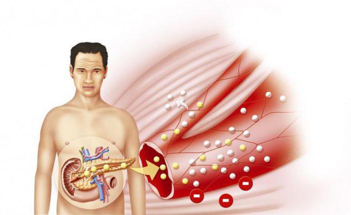 Diabetul zaharat 1, 2 tipuri. diferență