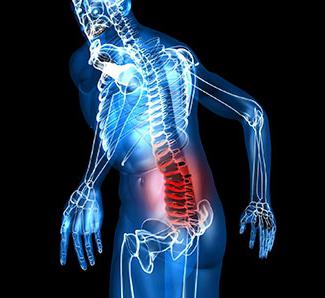 Injecții cu osteochondroză lombară