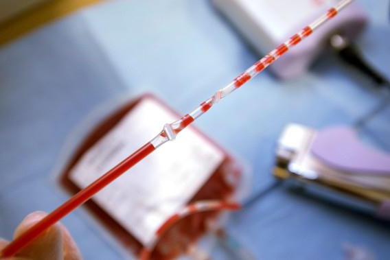 transfuzia de sânge cu hemoglobină scăzută este periculoasă
