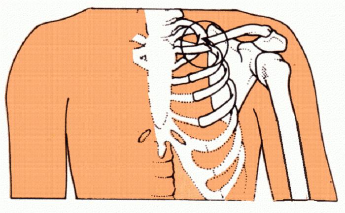 Fracturile claviculei: cauze, semne, tratament