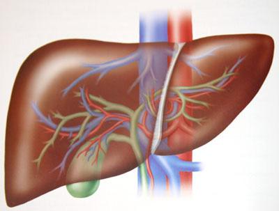 primele semne de ciroză hepatică 